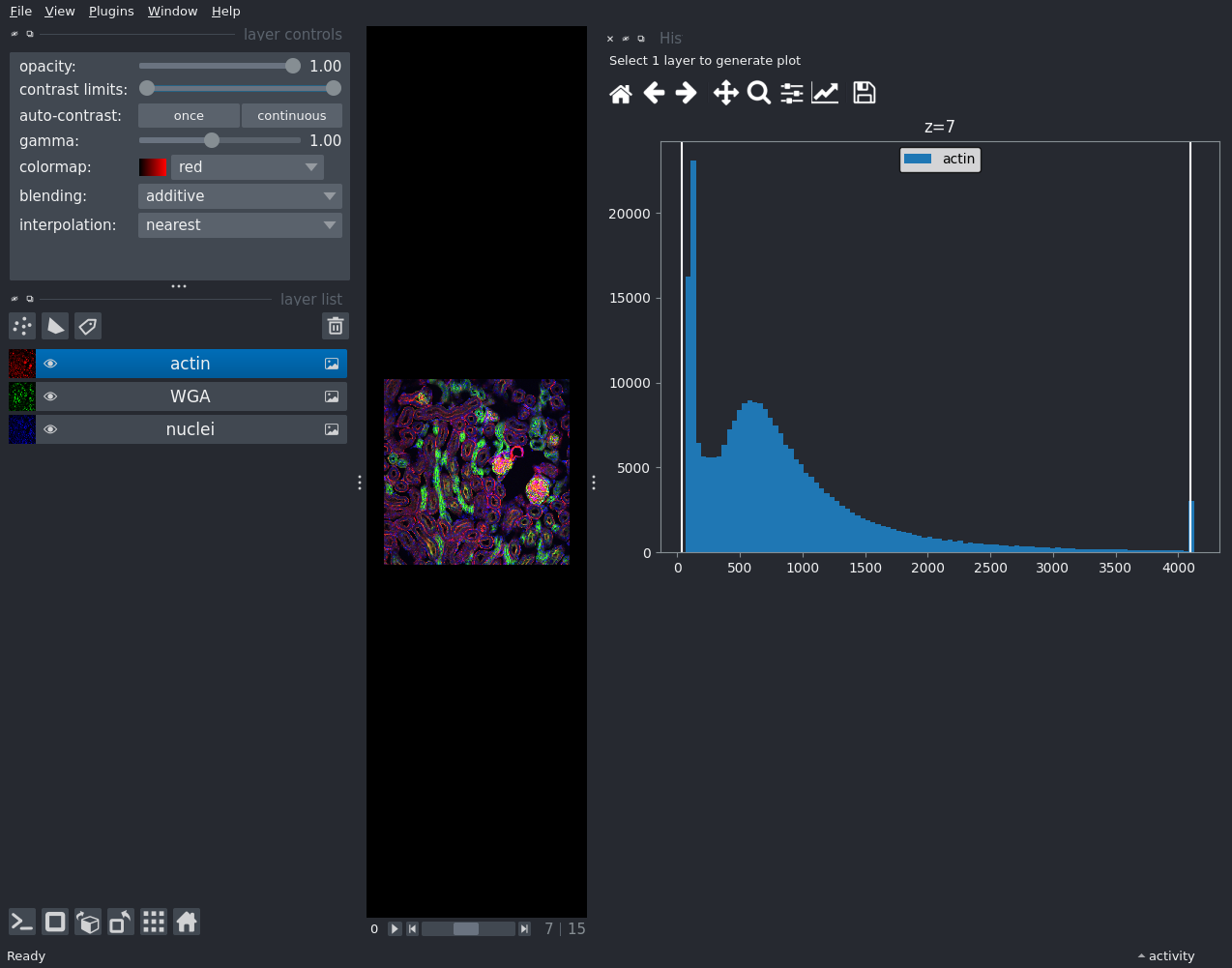 histogram